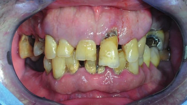 Figure 12 from the published case