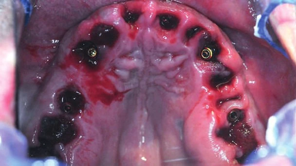 Figure 25 from the published case