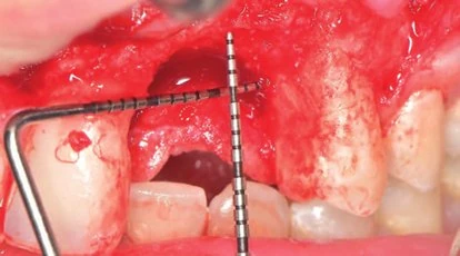 Figure 04 from the published case