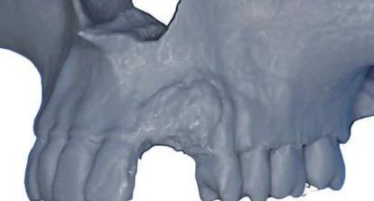 Figure 05 from the published case
