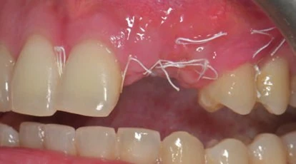 Figure 11 from the published case