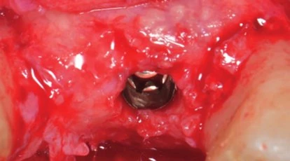 Figure 21 from the published case