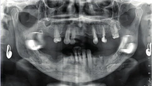 Figure 02 from the published case