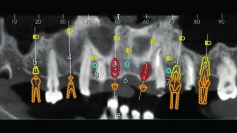 Figure 05 from the published case
