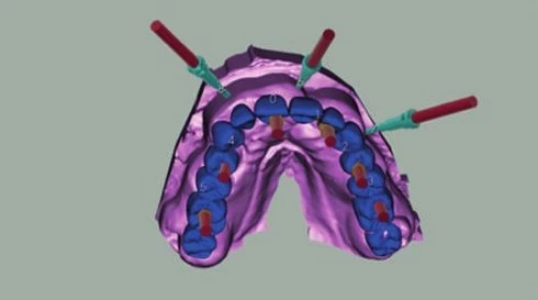 Figure 06 from the published case