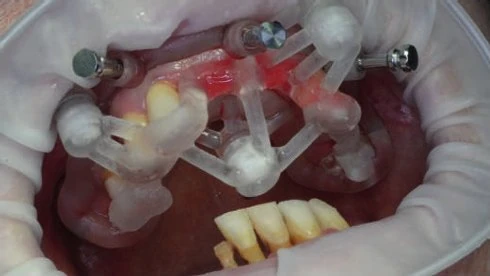 Figure 08 from the published case