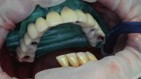 Figure 14 from the published case