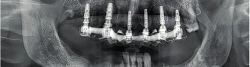 Figure 19 from the published case